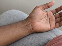 Relaxed palm-up hand and inner wrist resting on a gray cushion, showing natural skin creases.