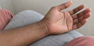 Relaxed palm-up hand and inner wrist resting on a gray cushion, showing natural skin creases.